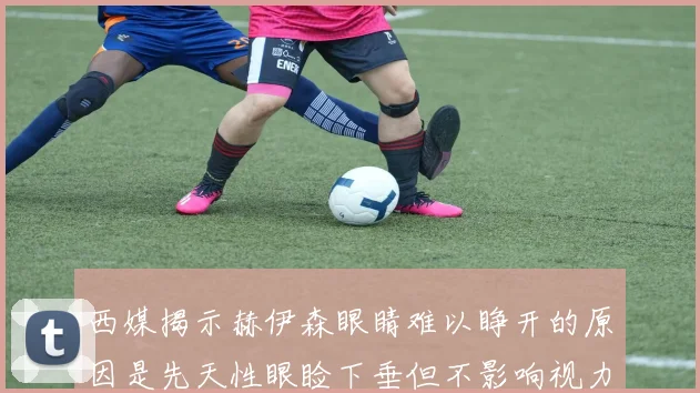 西媒揭示赫伊森眼睛难以睁开的原因是先天性眼睑下垂但不影响视力